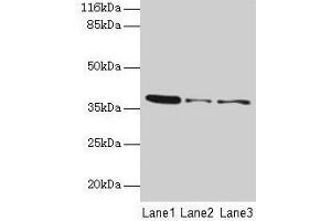 Western blot All lanes: MAS1 antibody at 2 μg/mL Lane 1: 293T whole cell lysate Lane 2: Colo320 whole cell lysate Lane 3: HepG2 whole cell lysate Secondary Goat polyclonal to rabbit IgG at 1/10000 dilution Predicted band size: 38 kDa Observed band size: 38 kDa (MAS1 Antikörper  (AA 285-325))