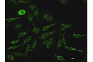 Immunofluorescence of purified MaxPab antibody to PDK4 on HeLa cell. (PDK4 Antikörper  (AA 1-411))