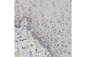 Immunohistochemistry of paraffin-embedded human esophagus using APP antibody (ABIN3020679, ABIN3020680, ABIN3020681 and ABIN6213663) at dilution of 1:100 (40x lens).