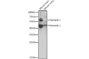 Western blot analysis of extracts of various cell lines, using Pannexin 1 antibody (ABIN6128523, ABIN6145204, ABIN6145206 and ABIN6217644) at 1:1000 dilution. (PANX1 Antikörper  (AA 297-426))