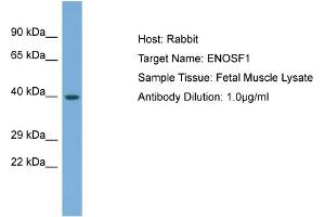 Host: Rabbit Target Name: ENOSF1 Sample Type: Fetal Muscle lysates Antibody Dilution: 1. (ENOSF1 Antikörper  (Middle Region))