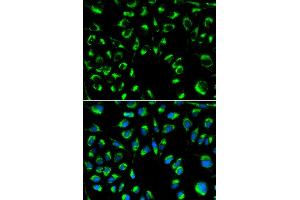 Immunofluorescence analysis of MCF-7 cells using PPP4C antibody. (PPP4C Antikörper)