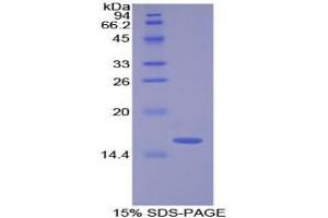 SDS-PAGE analysis of Cow Lysozyme Protein.