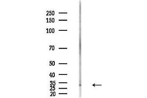 Western blot analysis of lysates from PC12 cells(LPS,4h treatment), using CA Antibody at 1/1000 dilution.