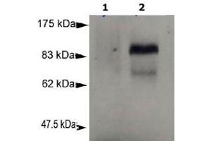 Detection of Prdm1 in murine plasmacytoma cell lysate (P3X) using Prdm1 monoclonal antibody, clone 3H2-E8 . (PRDM1 Antikörper  (AA 199-409))