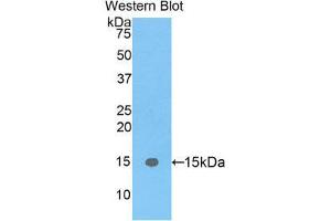 Western Blotting (WB) image for anti-Fatty Acid Binding Protein 5 (Psoriasis-Associated) (FABP5) (AA 2-135) antibody (ABIN1078019)