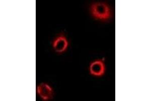 Immunofluorescent analysis of ArgRS staining in MCF7 cells. (ArgRS Antikörper)