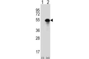 Western Blotting (WB) image for anti-Carbonic Anhydrase XIV (CA14) antibody (ABIN3003124)