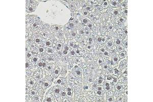 Immunohistochemistry of paraffin-embedded mouse liver using MYC antibody (ABIN4904459) at dilution of 1:100 (40x lens). (c-MYC Antikörper)