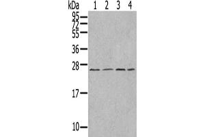Gel: 12 % SDS-PAGE,Lysate: 40 μg,Lane 1-4: A549 cells, Jurkat cells, A375 cells, HepG2 cells,Primary antibody: ABIN7192977(UBTD1 Antibody) at dilution 1/300 dilution,Secondary antibody: Goat anti rabbit IgG at 1/8000 dilution,Exposure time: 1 minute (UBTD1 Antikörper)