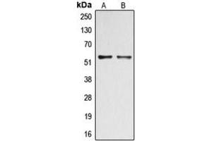Western blot analysis of DOK2 (pY299) expression in A549 Insulin-treated (A), HepG2 (B) whole cell lysates. (DOK2 Antikörper  (pTyr299))