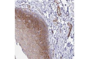 Immunohistochemical staining of human esophagus with KLC3 polyclonal antibody  shows moderate cytoplasmic positivity in squamous epithelial cells. (KLC3 Antikörper)