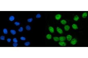 IF analysis of CoREST/RCOR1 using anti-CoREST/RCOR1 antibody (ABIN7601035).