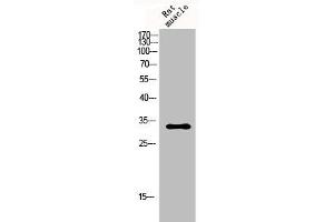 Western Blot analysis of rat-musle cells using p57 Polyclonal Antibody (CDKN1C Antikörper  (N-Term))