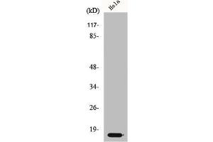 Western Blot analysis of HeLa cells using p14 Polyclonal Antibody (CDKN2A Antikörper  (Internal Region))