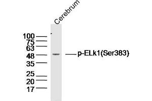 Mouse brain lysates probed with Elk1(Ser383) Polyclonal Antibody, unconjugated  at 1:300 overnight at 4°C followed by a conjugated secondary antibody at 1:10000 for 90 minutes at 37°C. (ELK1 Antikörper  (pSer383))