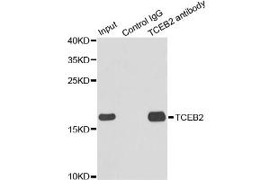Immunoprecipitation analysis of 150ug extracts of MCF7 cells using 3ug TCEB2 antibody. (TCEB2 Antikörper)