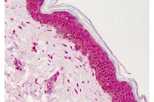 Human Skin: Formalin-Fixed, Paraffin-Embedded (FFPE) (PPARG Antikörper  (Internal Region))