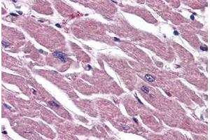 Human Heart (formalin-fixed, paraffin-embedded) stained with UIMC1 antibody ABIN343913 at 5 ug/ml followed by biotinylated goat anti-rabbit IgG secondary antibody ABIN481713, alkaline phosphatase-streptavidin and chromogen.