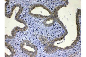 Immunohistochemistry (IHC) image for anti-UDP Glucuronosyltransferase 1 Family, Polypeptide A1 (UGT1A1) (AA 316-533) antibody (ABIN5693290)