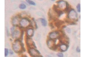 Cytokeratin 19 anticorps  (AA 245-391)