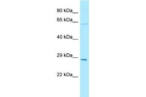 WB Suggested Anti-THTPA Antibody Titration: 1.