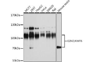Western blot analysis of extracts of various cell lines, using EZH2/KMT6 antibody (ABIN6133509, ABIN6140393, ABIN6140396 and ABIN6215059) at 1:1000 dilution. (EZH2 Antikörper  (AA 1-250))