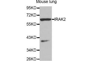 Western Blotting (WB) image for anti-Interleukin-1 Receptor-Associated Kinase 2 (IRAK2) (AA 1-270) antibody (ABIN3016607) (IRAK2 Antikörper  (AA 1-270))