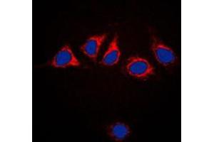 Immunofluorescent analysis of Calnexin staining in HeLa cells. (Calnexin Antikörper  (C-Term))
