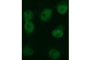 Image no. 3 for anti-Tubulin, beta 2B (TUBB2B) antibody (ABIN1501572) (TUBB2B Antikörper)