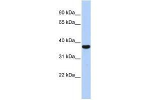 EXOSC2 antibody used at 1 ug/ml to detect target protein. (EXOSC2 Antikörper  (Middle Region))