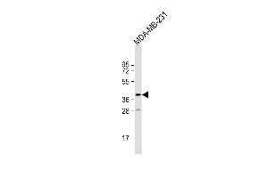 Western Blot at 1:1000 dilution + MDA-MB-231 whole cell lysate Lysates/proteins at 20 ug per lane. (TAS2R31 Antikörper  (C-Term))