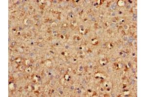 Immunohistochemistry of paraffin-embedded human brain tissue using ABIN7170725 at dilution of 1:100 (STMN2 Antikörper  (AA 61-129))