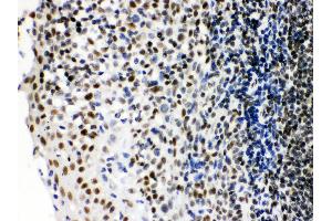 Anti- Ku70 Picoband antibody, IHC(P) IHC(P): Human Tonsil Tissue (XRCC6 Antikörper  (C-Term))