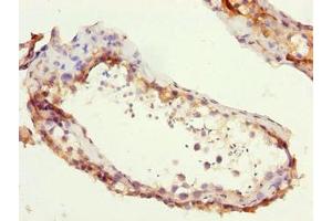 Immunohistochemistry of paraffin-embedded human testis tissue using ABIN7176044 at dilution of 1:100 (ZCCHC13 Antikörper  (AA 1-166))