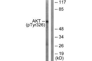 Western blot analysis of extracts from mouse liver cells, using Akt (Phospho-Tyr326) antibody. (AKT1 Antikörper  (pTyr326))