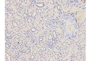 Immunohistochemistry (IHC) image for anti-TNF Receptor Superfamily, Member 6 (FAS) (AA 150-250) antibody (ABIN3020739)