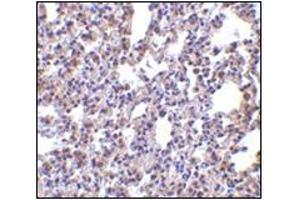 Immunohistochemistry of PKR in rat lung tissue with this product at 2. (EIF2AK2 Antikörper  (C-Term))