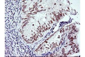 Image no. 3 for anti-Ring Finger Protein 113B (RNF113B) antibody (ABIN1500715) (RNF113B Antikörper)