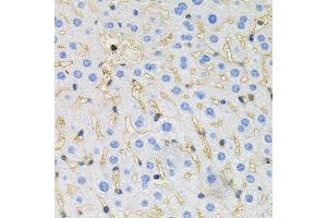 Immunohistochemistry of paraffin-embedded mouse liver using MAPT antibody (ABIN5970456) at dilution of 1/100 (40x lens). (MAPT Antikörper)