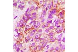 Immunohistochemistry (IHC) image for anti-N-Myc Downstream Regulated 1 (NDRG1) antibody (ABIN7308066) (NDRG1 Antikörper)
