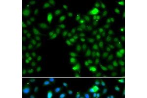 Immunofluorescence analysis of MCF-7 cells using ING5 Polyclonal Antibody (ING5 Antikörper)