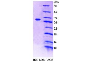 SDS-PAGE (SDS) image for G-Elongation Factor, Mitochondrial 1 (GFM1) (AA 511-751) protein (His tag) (ABIN4989302)