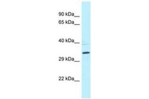 Image no. 1 for anti-Protein Phosphatase 2A Activator, Regulatory Subunit 4 (PPP2R4) (AA 39-88) antibody (ABIN6747835) (PPP2R4 Antikörper  (AA 39-88))