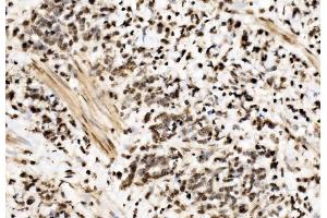 IHC analysis of SPHK1 using anti-SPHK1 antibody (ABIN7600168). (SPHK1 Antikörper  (AA 16-267))