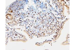 IHC analysis of MCM2 using anti-MCM2 antibody (ABIN7601593).