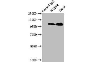 Immunoprecipitating NUP98 in Jurkat whole cell lysate Lane 1: Rabbit control IgG instead of ABIN7161832 in Jurkat whole cell lysate. (NUP98 Antikörper  (AA 965-1110))