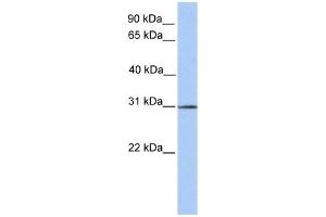 SURF4 antibody used at 1 ug/ml to detect target protein. (Surfeit 4 Antikörper  (N-Term))