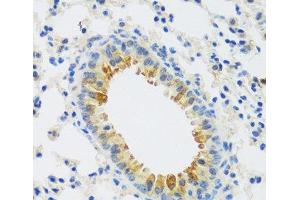 Immunohistochemistry of paraffin-embedded Mouse lung using CAMK1 Polyclonal Antibody at dilution of 1:100 (40x lens). (CAMK1 Antikörper)