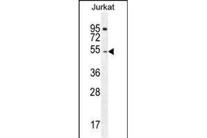 DARS Antibody (N-term) (ABIN655040 and ABIN2844671) western blot analysis in Jurkat cell line lysates (35 μg/lane). (DARS Antikörper  (N-Term))
